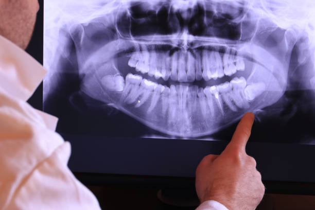 Best Same-Day Emergency Dentist in Cave Springs, AR